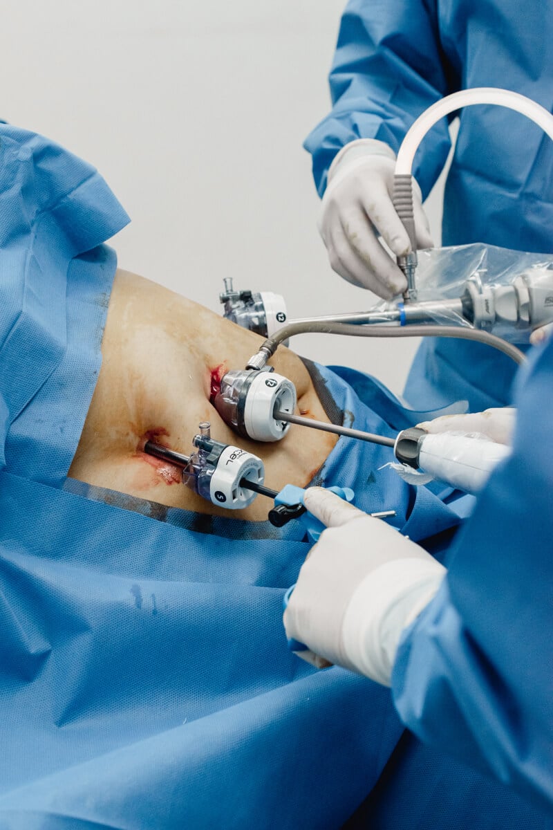 JL Prado's skilled surgical team performing a weight loss procedure