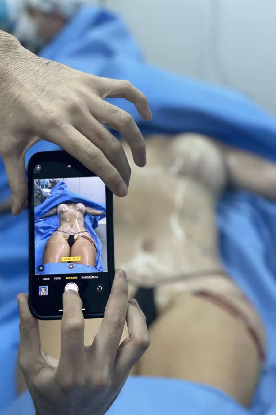 doctor taking an after procedure picture of a patient