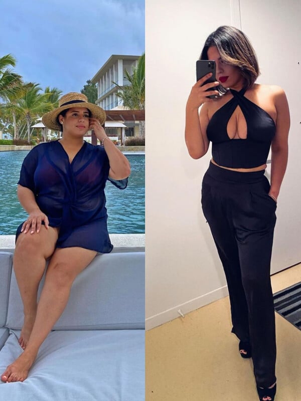 Depicting patient's life-changing weight loss journey with JL Prado Surgical Center through before and after photos