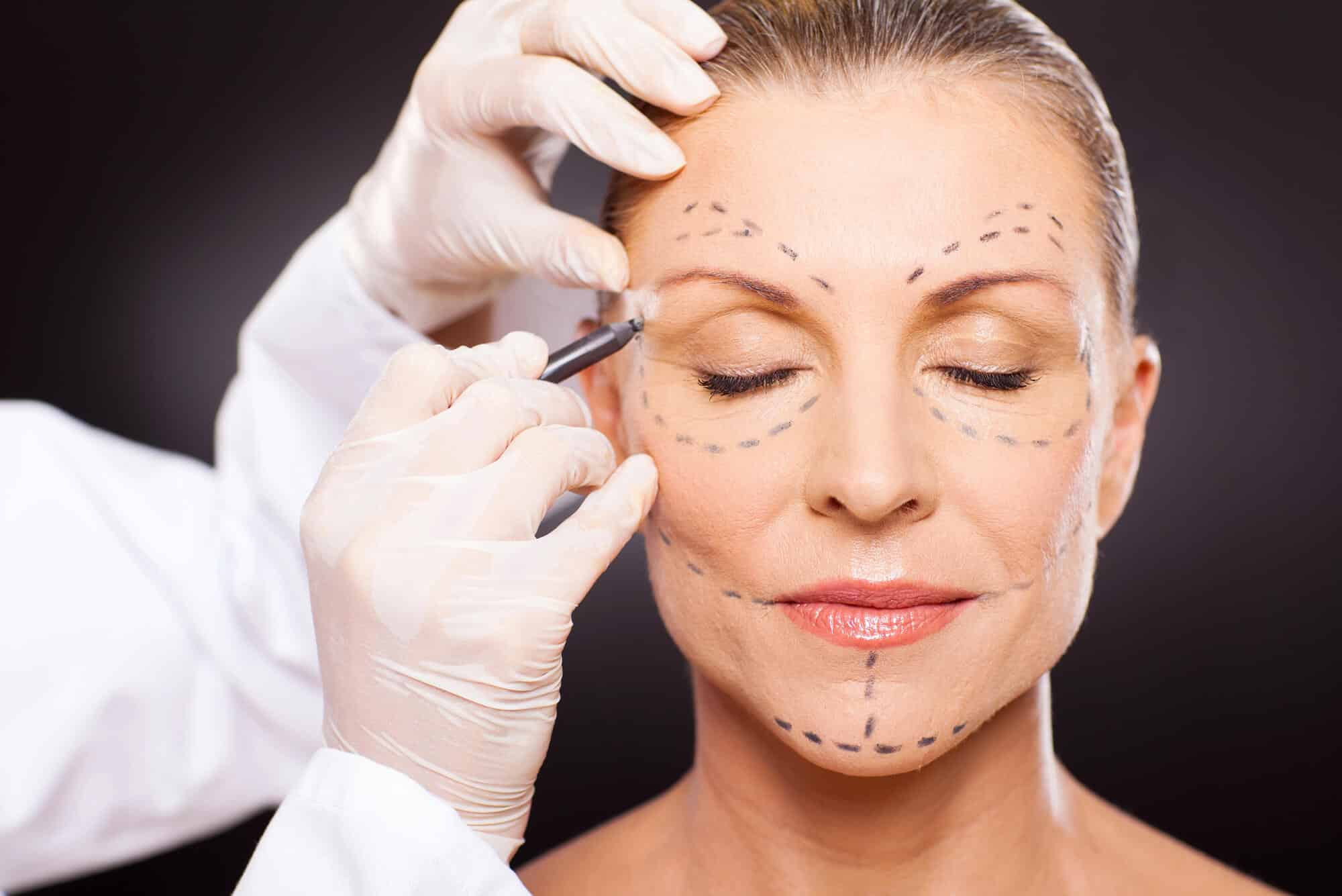 Close-up of a woman's youthful face after a successful estiramiento facial, highlighting smooth skin and defined facial contours.
