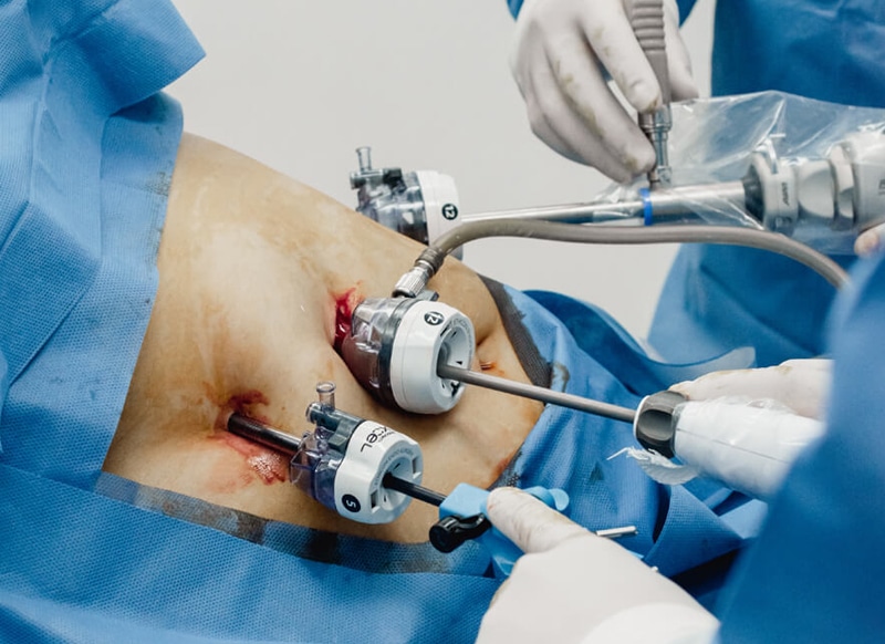 surgical procedure