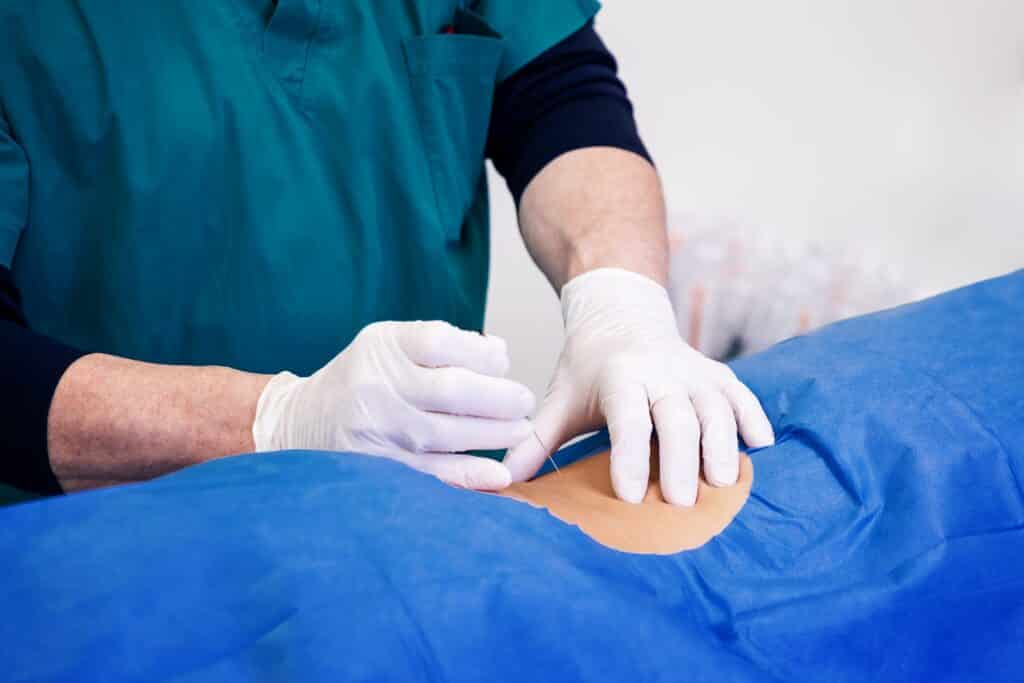 Fotografia representando los diferentes tipos de cirugia general realizados en JL Prado