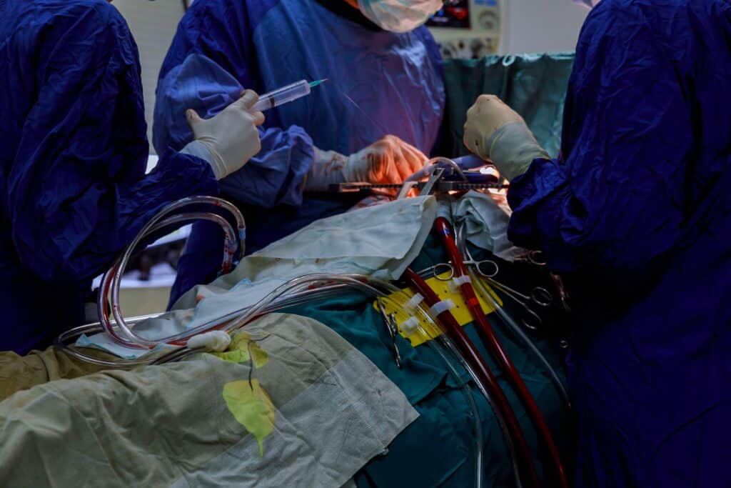 Fotografia alusiva al procedimiento de bypass gastrico en JL prado en tijuana