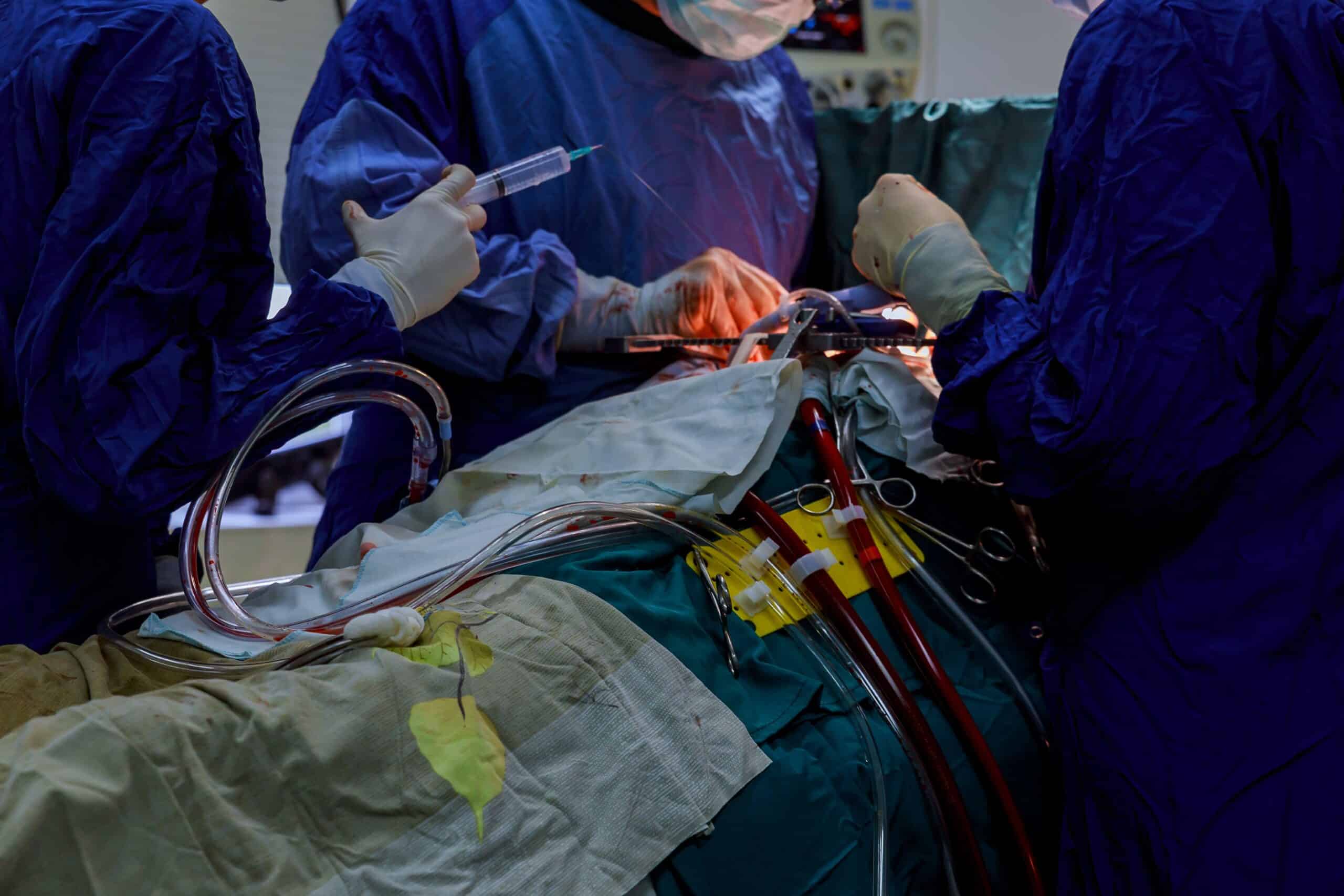 Fotografia alusiva al procedimiento de bypass gastrico en JL prado en tijuana