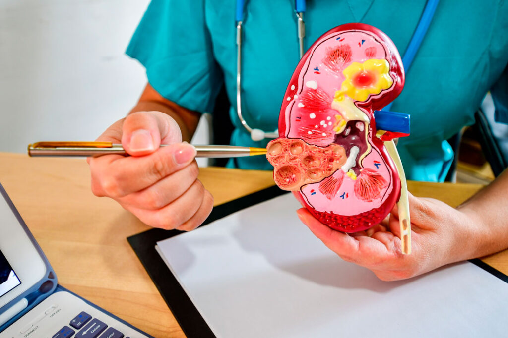 Image of a doctor explaining a kidney model with a pen, highlighting various parts of the kidney."