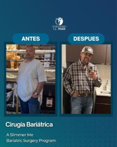 Before and after image of a patient highlighting the weight loss achieved through bariatric surgery at JL Prado.