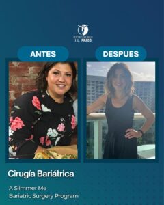 Before and after bariatric surgery at JL Prado, showcasing significant weight loss and positive change in the patient's appearance.