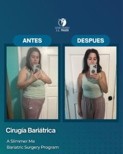 Before and after bariatric surgery at JL Prado, highlighting the patient's physical transformation and health improvement.