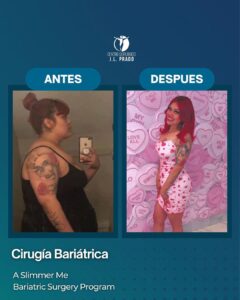 Before and after image of a patient who underwent bariatric surgery at JL Prado Surgical Center. The 'before' photo shows the patient prior to surgery, and the 'after' photo highlights the significant weight loss and transformation achieved through the A Slimmer Me Bariatric Surgery Program.