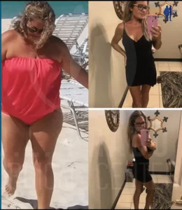 before and after results of a woman who had bariatric surgery and lost a considerable amount of weight